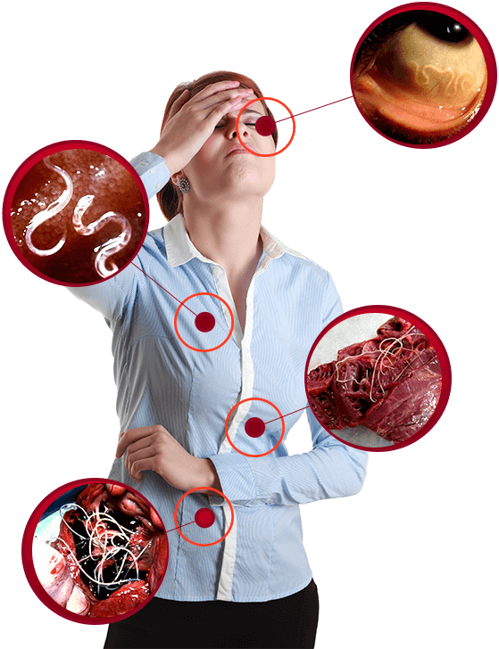 вред паразитов для организма